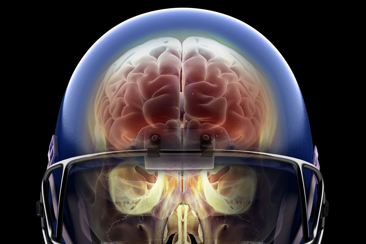 NFL Player Head Injuries: A History